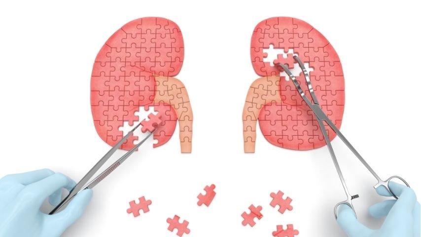 How ECIRS Works- Step-by-Step Breakdown of the Combined Antegrade and Retrograde Technique