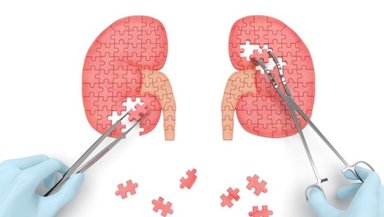 How ECIRS Works- Step-by-Step Breakdown of the Combined Antegrade and Retrograde Technique How ECIRS Works- Step-by-Step Breakdown of the Combined Antegrade and Retrograde Technique