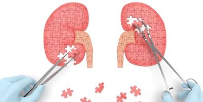 How ECIRS Works- Step-by-Step Breakdown of the Combined Antegrade and Retrograde Technique How ECIRS Works- Step-by-Step Breakdown of the Combined Antegrade and Retrograde Technique