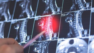 Slipped Disc, Herniated Disc, or Sciatica- What’s the Real Difference Slipped Disc, Herniated Disc, or Sciatica- What’s the Real Difference