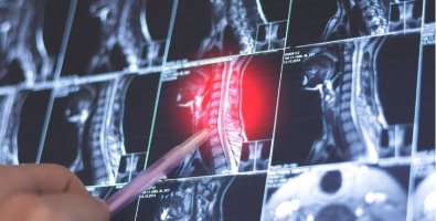 Slipped Disc, Herniated Disc, or Sciatica- What’s the Real Difference Slipped Disc, Herniated Disc, or Sciatica- What’s the Real Difference