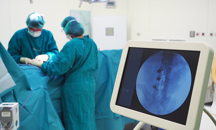 back-pain-treatments-minimally-invasive