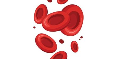 High Platelet Volume- Causes, Symptoms, and Treatment Options High Platelet Volume- Causes, Symptoms, and Treatment Options