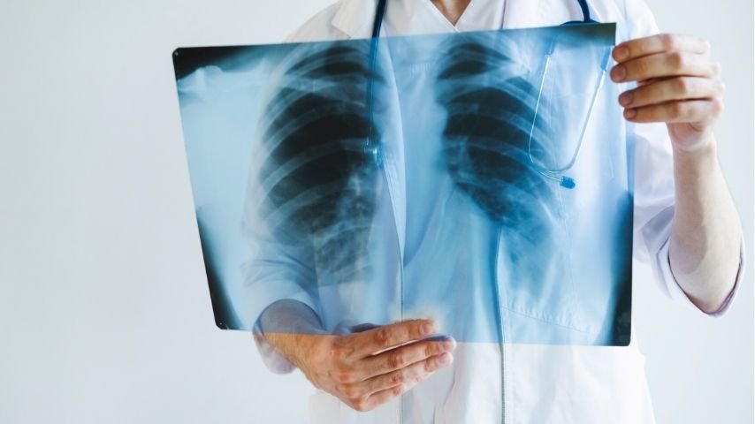 Should You Agree to a Transbronchial Lung Biopsy- Questions Patients Wish They Asked First Should You Agree to a Transbronchial Lung Biopsy- Questions Patients Wish They Asked First