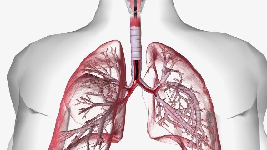 How Accurate Is Navigation Bronchoscopy for Diagnosing Lung Nodules