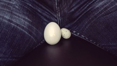 Why Do I Feel a Heavy or Dragging Sensation in My Testicle- Could It Be Varicocele Why Do I Feel a Heavy or Dragging Sensation in My Testicle- Could It Be Varicocele