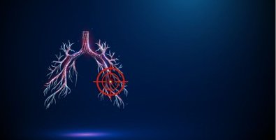 Common Questions Answered-How Safe Is TBNA and What Are the Risks Common Questions Answered-How Safe Is TBNA and What Are the Risks