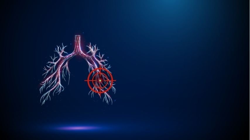 Common Questions Answered-How Safe Is TBNA and What Are the Risks Common Questions Answered-How Safe Is TBNA and What Are the Risks