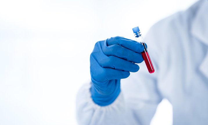 What is PSA test What is PSA test
