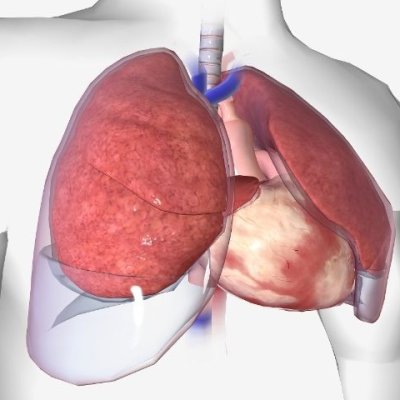 Toracoiscopia What Is Medical Thoracoscopy? Procedure Explained