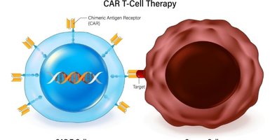 Cost, Access, and Where to Get CAR-T Therapy- A Practical Guide for Patients Cost, Access, and Where to Get CAR-T Therapy- A Practical Guide for Patients
