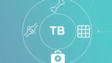 Bone TB- Causes, Symptoms, Treatment, and Best Recovery Methods Bone TB- Causes, Symptoms, Treatment, and Best Recovery Methods