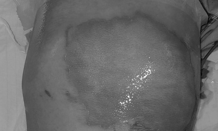Damaged skin - in text image