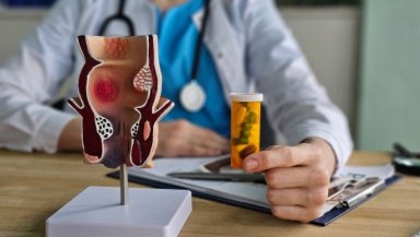 Do You Really Need Hemorrhoidectomy- 7 Signs That Surgery May Be the Right Option for Your Piles Do You Really Need Hemorrhoidectomy- 7 Signs That Surgery May Be the Right Option for Your Piles