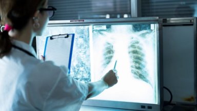 Risks After a Lung Transplant-Rejection, Infection & How Doctors Prevent Complications Risks After a Lung Transplant-Rejection, Infection & How Doctors Prevent Complications