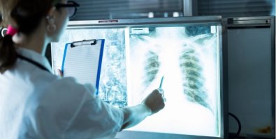 Risks After a Lung Transplant-Rejection, Infection & How Doctors Prevent Complications Risks After a Lung Transplant-Rejection, Infection & How Doctors Prevent Complications