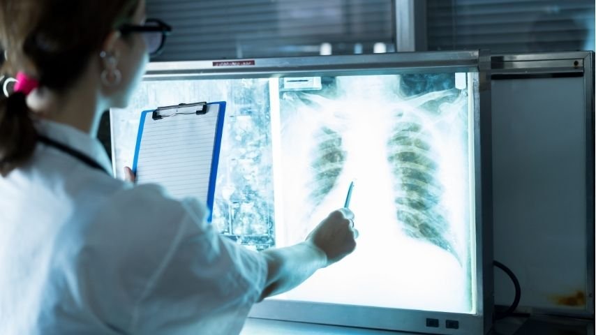 Risks After a Lung Transplant-Rejection, Infection & How Doctors Prevent Complications Risks After a Lung Transplant-Rejection, Infection & How Doctors Prevent Complications