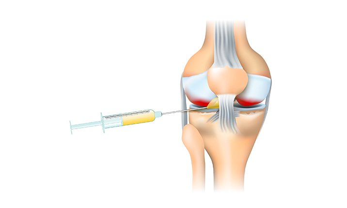 A pain specialist doing a clinical evaluation of the patient’s knee function knee-injections