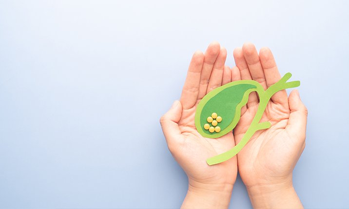 gallstones-link-to-fatty-liver