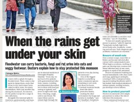 When the rains get under your skin When the rains get under your skin