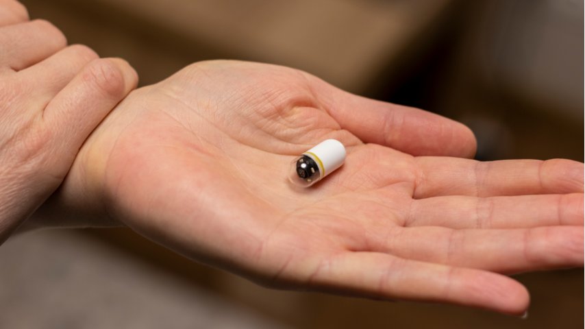 Capsule Endoscopy vs Colonoscopy- Which Test Can Reveal More About Your Gut Capsule Endoscopy vs Colonoscopy- Which Test Can Reveal More About Your Gut