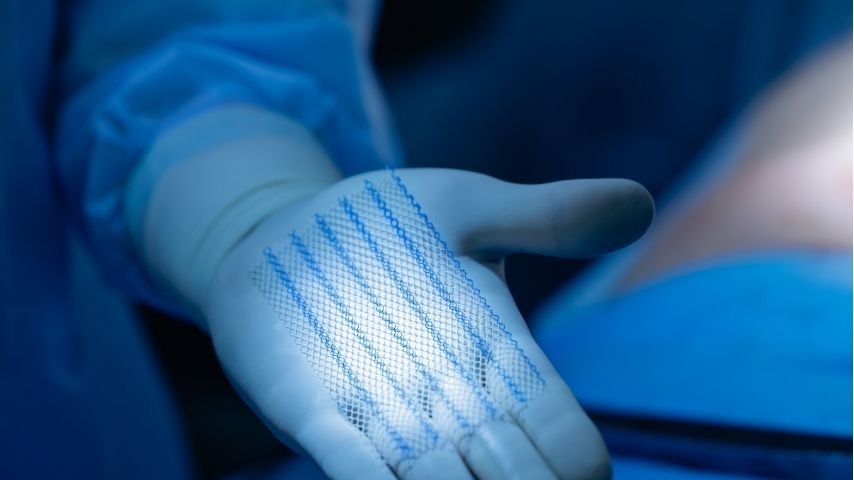 Hernia Mesh- Is It Safe, Can You Feel It, and What Happens After Surgery