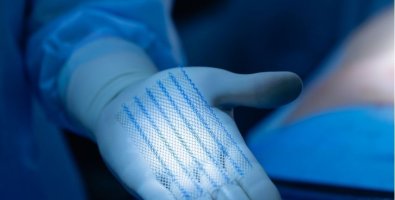 Hernia Mesh- Is It Safe, Can You Feel It, and What Happens After Surgery Hernia Mesh- Is It Safe, Can You Feel It, and What Happens After Surgery