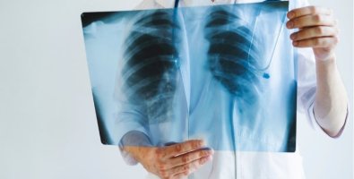 What Happens During a CT-Guided Lung Biopsy- Step-by-Step Guide for Patients What Happens During a CT-Guided Lung Biopsy- Step-by-Step Guide for Patients