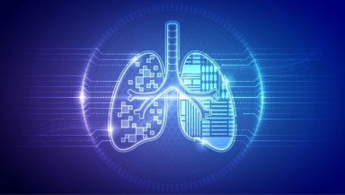 What Happens During a Navigation Bronchoscopy- Step-by-Step Guide for Patients What Happens During a Navigation Bronchoscopy- Step-by-Step Guide for Patients