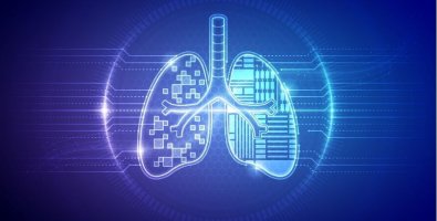 What Happens During a Navigation Bronchoscopy- Step-by-Step Guide for Patients What Happens During a Navigation Bronchoscopy- Step-by-Step Guide for Patients