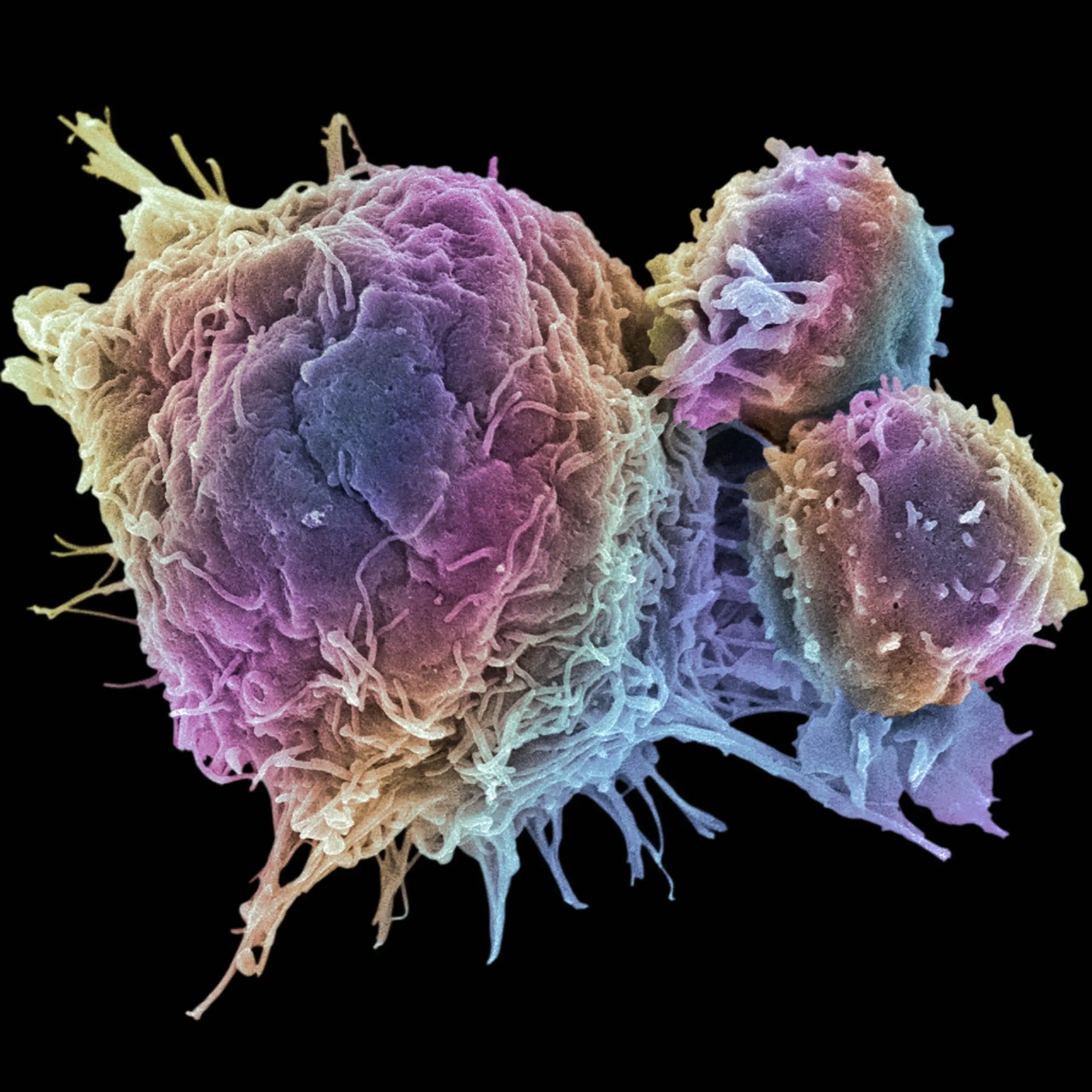 Small-Molecules_Cancer Cell and T Lymphocytes 