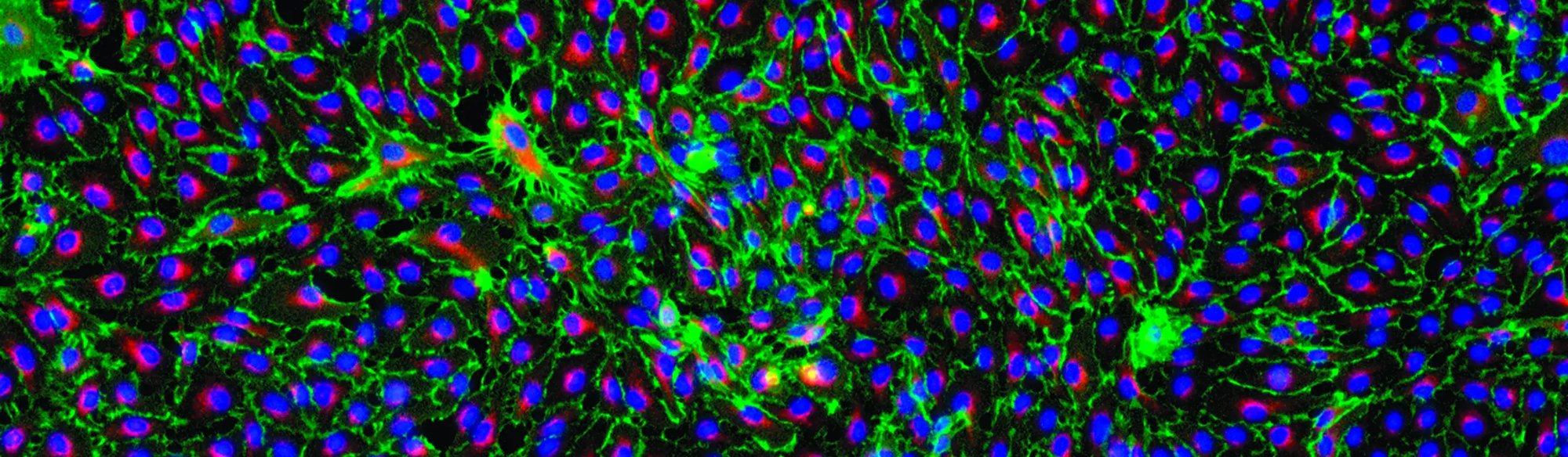 CC-2810_Fact_VII_Red_CD31_Green_Dapi_Blue_2_8195