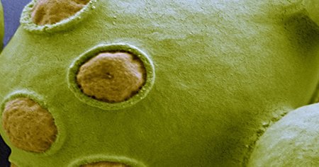 举例：毕赤酵母和大肠杆菌表达