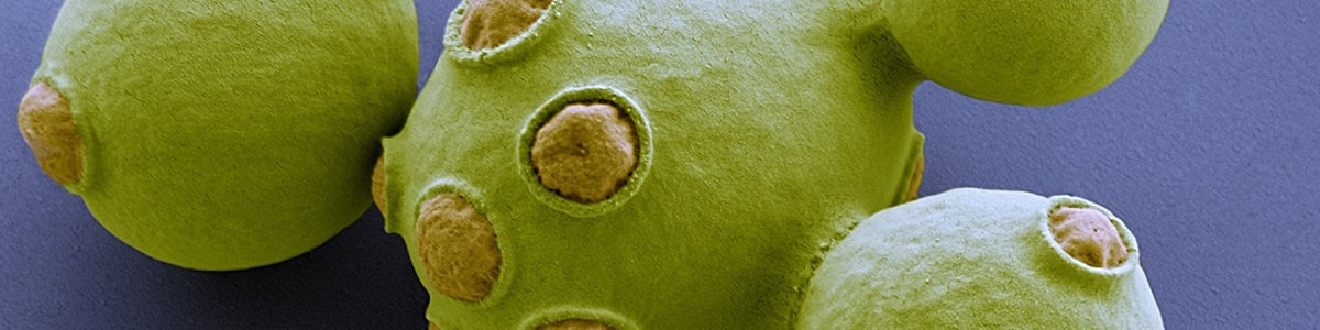 举例：毕赤酵母和大肠杆菌表达