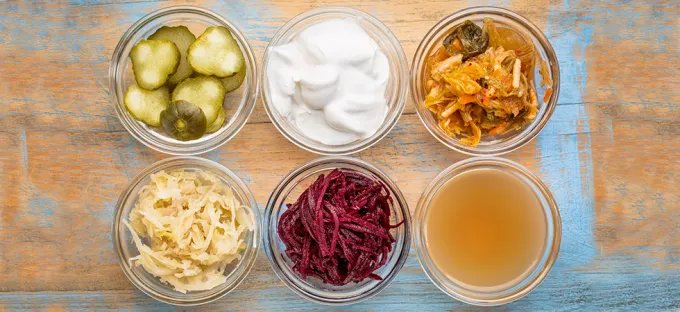 Assortment of fermented foods including pickles, yogurt, kimchi, sauerkraut, beets, and kombucha.