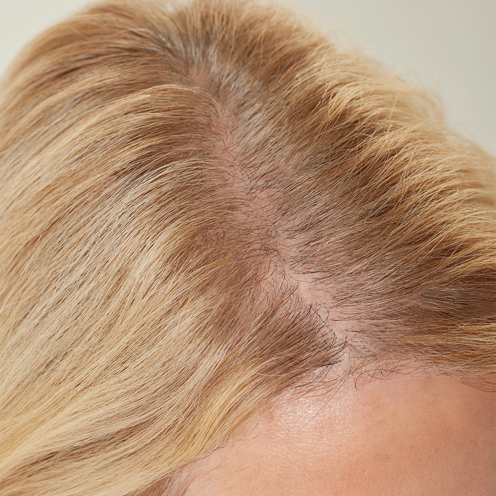 Before and after applying Boldify Hairline Powder along the part line