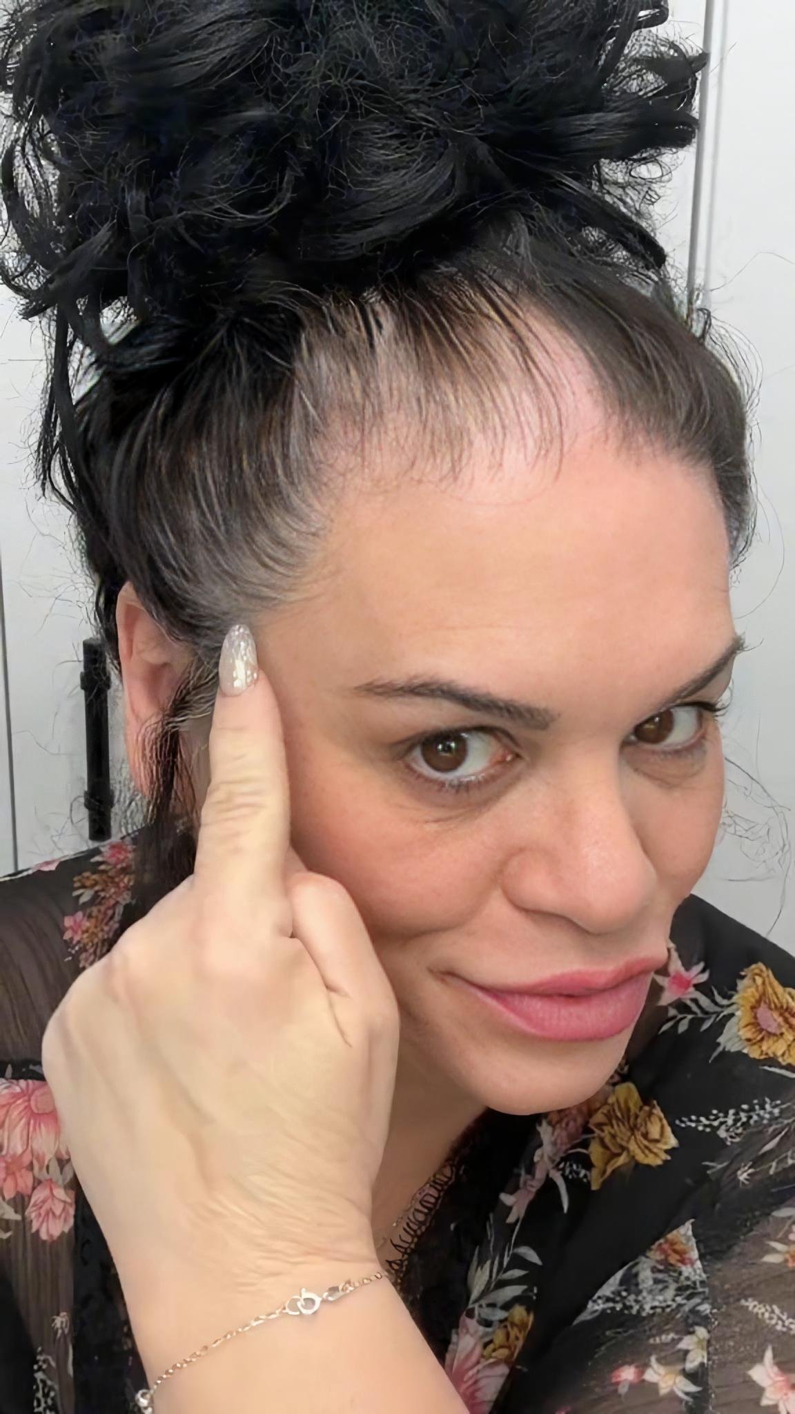 Visible gray roots at the hairline before applying Boldify Hairline Powder