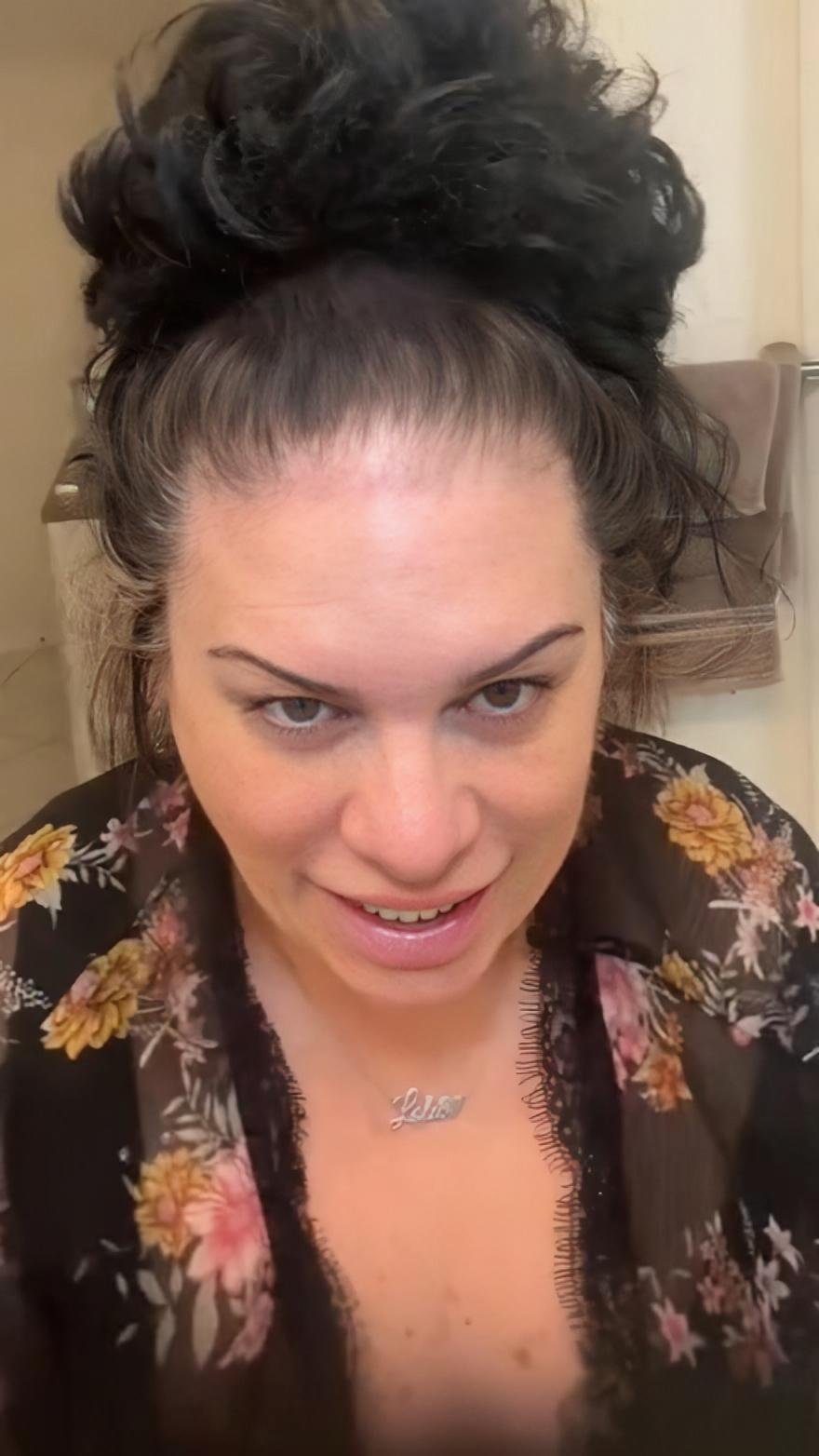 After using Boldify Hairline Powder and Hair Fibers