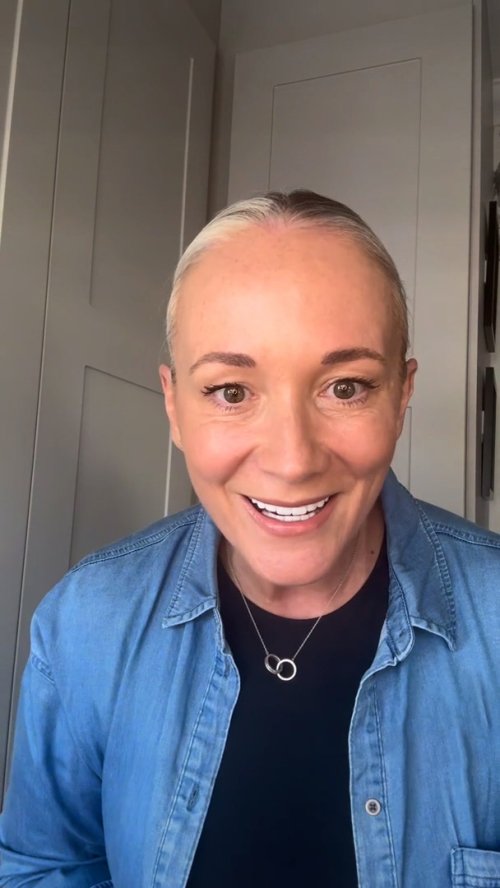 After, Light Blonde hairline