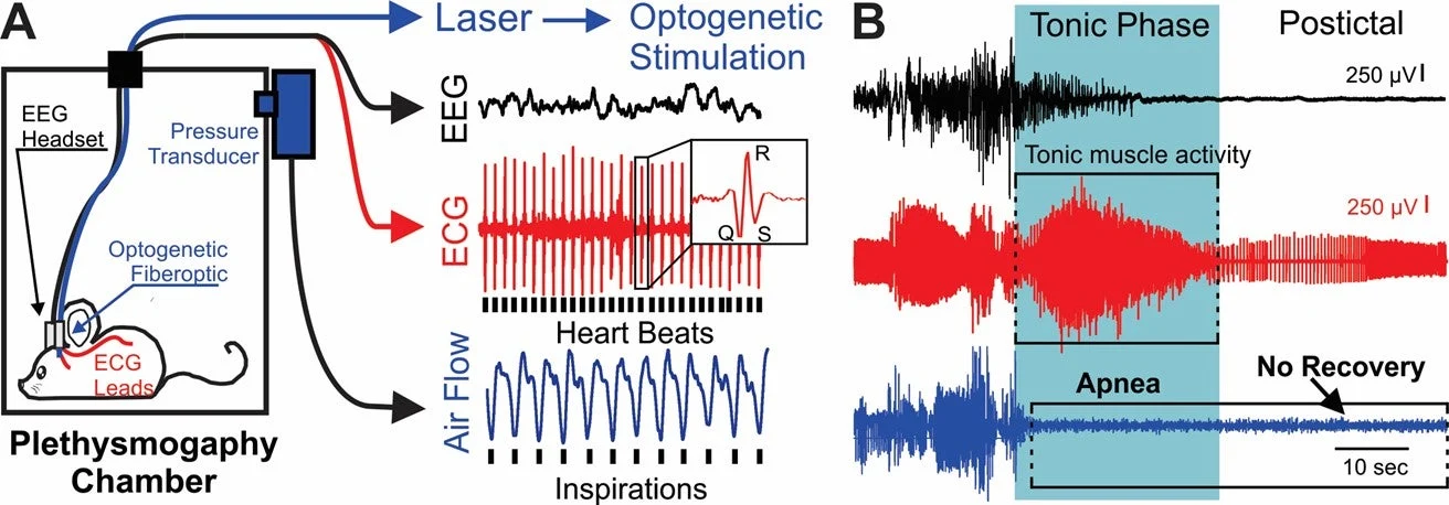 Figure 1. A, Diagram of setup. B, EEG, ECG, and breathing (pleth) recording during a spontaneous seizure-induced death (aka SUDEP).