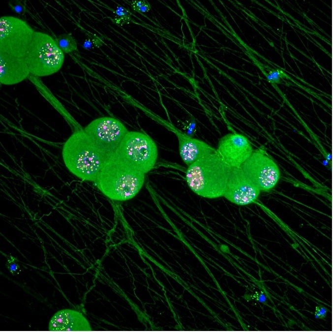 Our lab has shown that the HSV-1 latency and reactivation can be impacted by the state of the neuron during initial infection. In one study, we showed that exposure to type I IFN during initial HSV infection resulted in a repressive form of latency that is unable to reactivate. We found this was due to the formation and association of viral genomes with PML nuclear bodies. In a recent study, we have found that cell stress during initial infection has the opposite effect and results in latency that is more capable of reactivating. Both these studies highlight how neurons and the viral genome possess memory of previous stimuli. We are working on how these intersect with epigenetic changes to the host and/or virus.