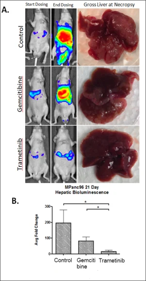 tumor inhibition by trametinib and Gemcitibine shown by luminescence