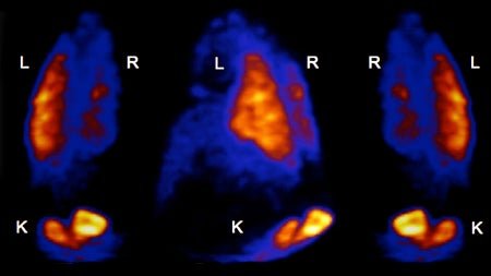 Our lab has multiple research projects underway including: 1) role of TRPV4 and Piezo1 channels in lung ischemia-reperfusion injury (IRI) after transplant, 2) testing therapeutic strategies to prevent IRI, 3) vascular endothelial barrier, 4) reconditioning lungs via EVLP, and 5) IVLP-mediated attenuation of ARDS.