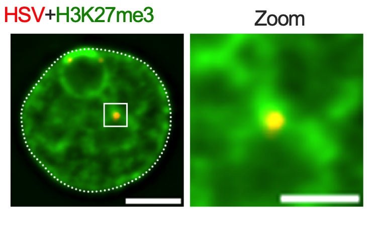 The outcome of HSV infection is linked to the type of chromatin associated with viral genomes. Our lab is investigating the mechanisms by which host and viral factors impact chromatin association following entry of naked viral genomes into the nucleus of different cell types. We are also interested in 
the mechanisms of remodeling during reactivation, especially during initial exit from latency, and how the type of silent heterochromatin on latent genomes impacts the ability of the virus to reactivate.