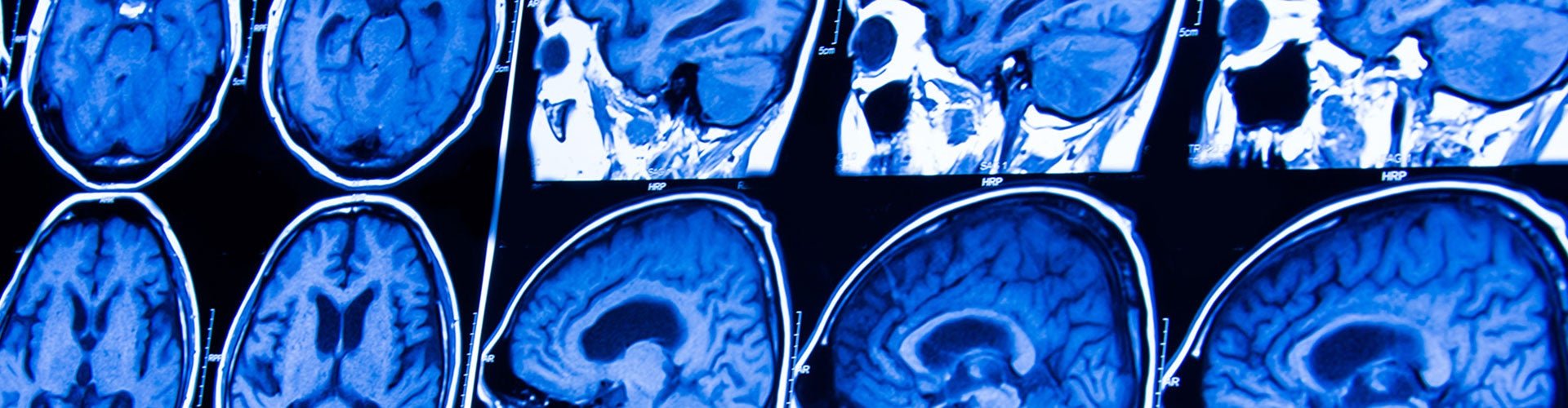 neurosurgery_hero_1920x500