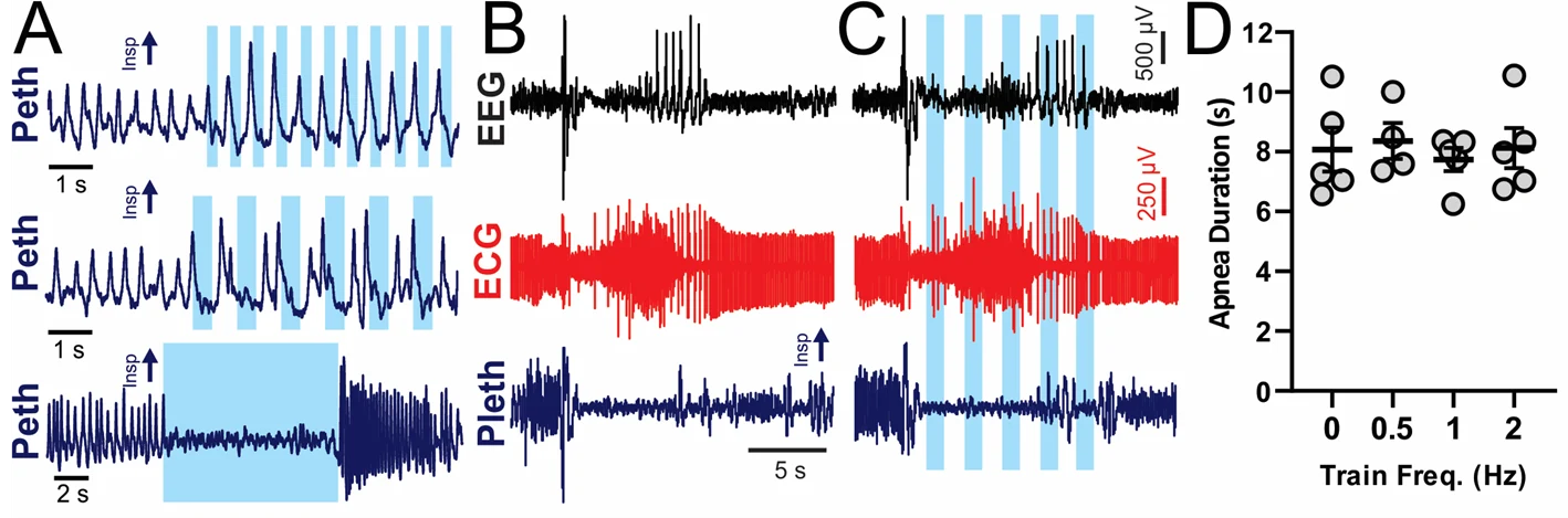 Figure 2. [All light blue shading represents photostimulation of 20 ms pulses at 20 Hz.] A, BötC photostimulation inhibits inspiratory activity. B-C, Audiogenic seizures in D/+ mice with no photostimulation (B) or 1 s, 2 Hz, trains during apnea. D, Apnea duration was unchanged by BötC photostimulation protocols designed to mimic slow breathing (p 