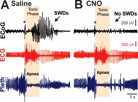Figure 3. Cortical ictal activity is not required for seizure-induced apnea. A) Normally, a brief attenuation rapidly evolving to cortical spike wave discharge is coincident with the tonic phase and apnea. B) However, inhibition of cortical neurons with the selective ligand CNO inhibits the cortical ictal activity, including the attenuation, spike wave discharges (SWDs), and postictal EEG suppression, but had no effect on the tonic phase or apnea. Asterisks indicate movement artifact.