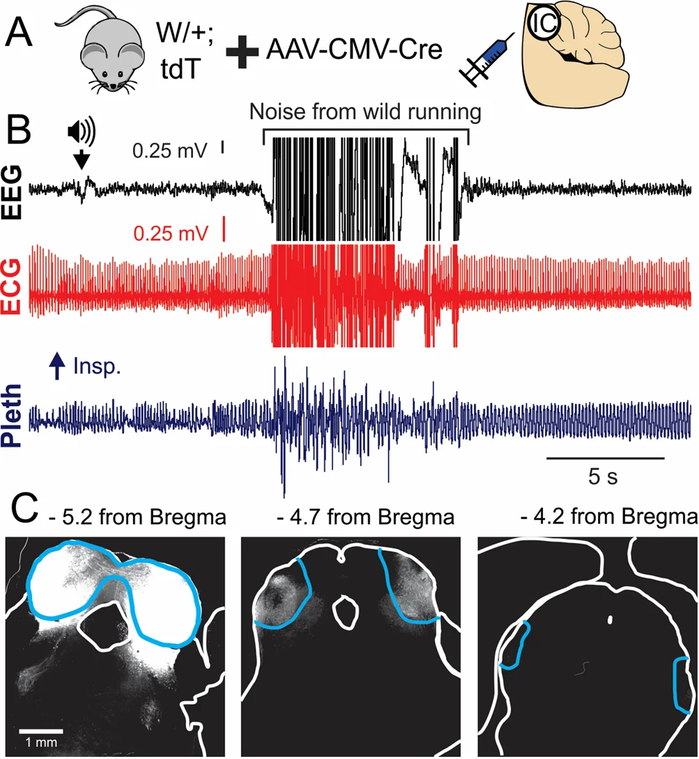 Figure 4. A) Cre expression in the inferior colliculus (IC) of W/+;LSL-tdTomato mice. B) EEG, ECG, and breathing (pleth) recording of an audiogenic seizure. C) Cre-mediated reporter expression is restricted to the IC (blue outline).