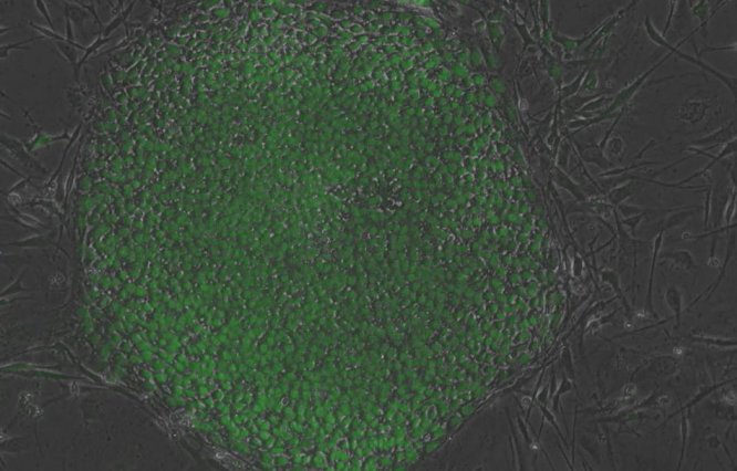 The UVA Stem Cell Core provides research-grade induced pluripotent stem cells (iPSCs), customized cell derivatives, and training to support the development of clinical-quality cells for human therapies.