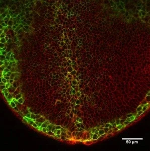 cancer cell